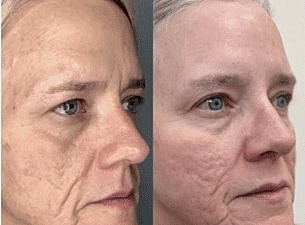 Smiling woman with curly hair and glowing skin.
