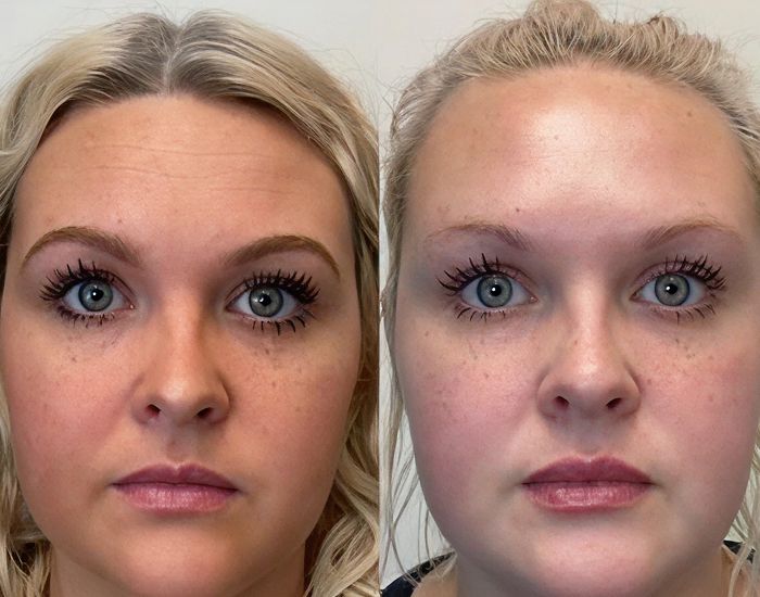 Before and after facial transformation comparison.