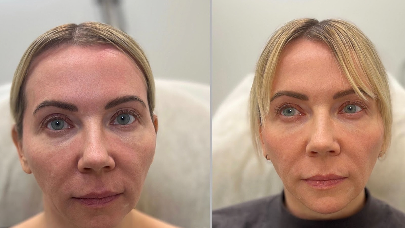 Buy Two Get One Free Offer