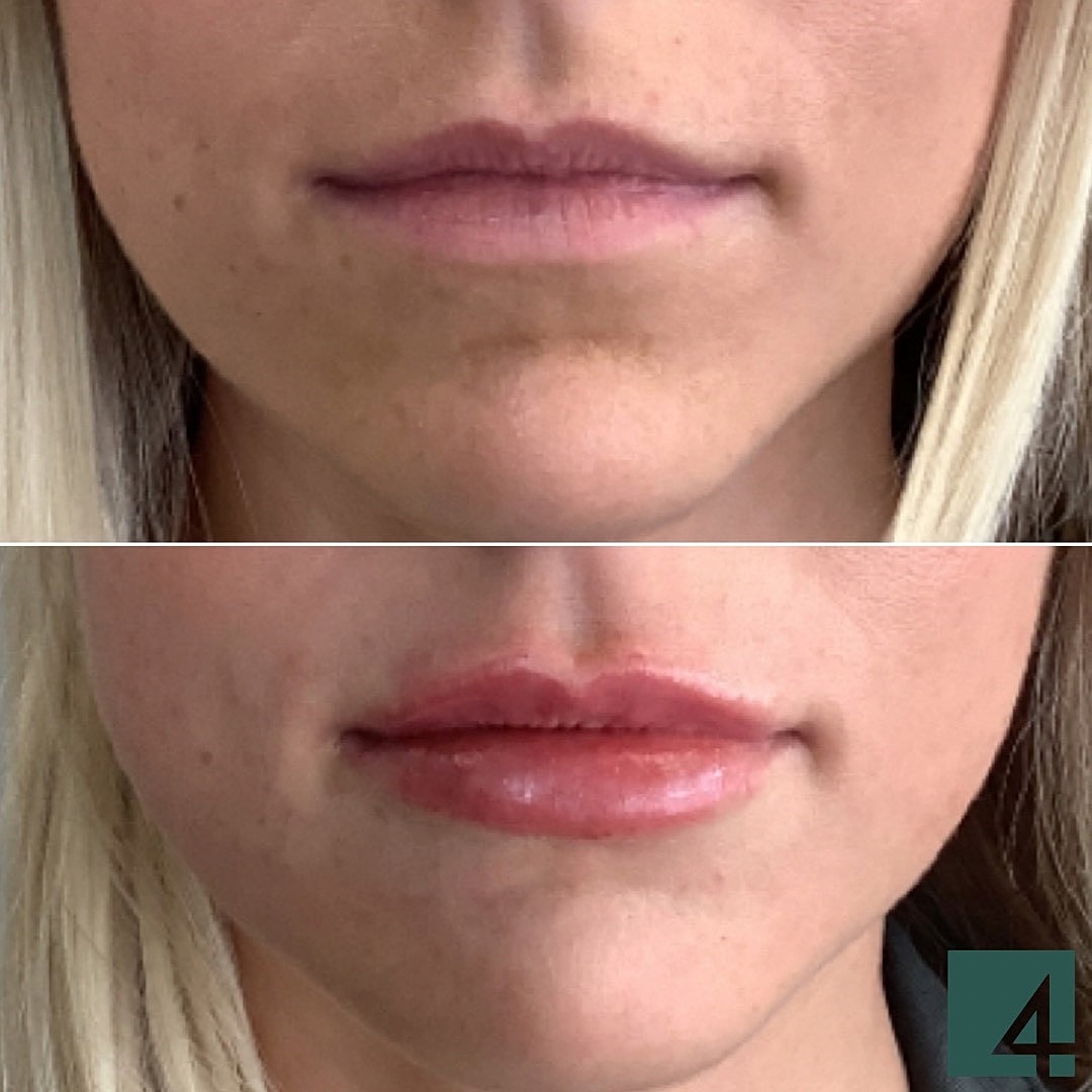 Early Access Granted!!