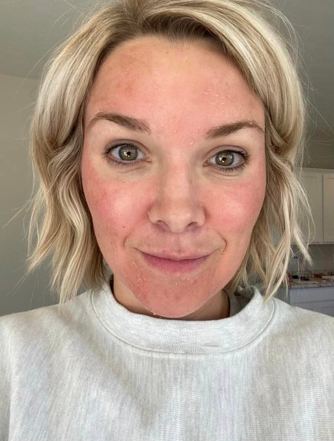 Love the sun, but not the spots?