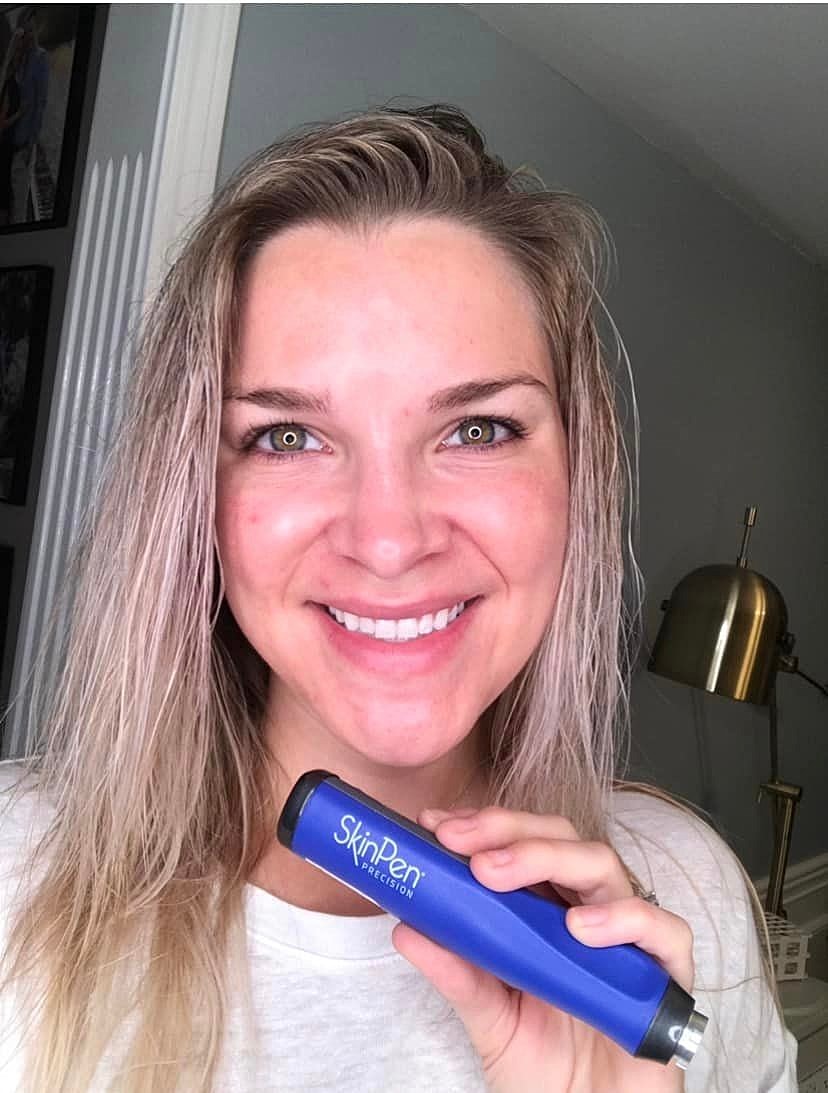 Natural Collagen Production