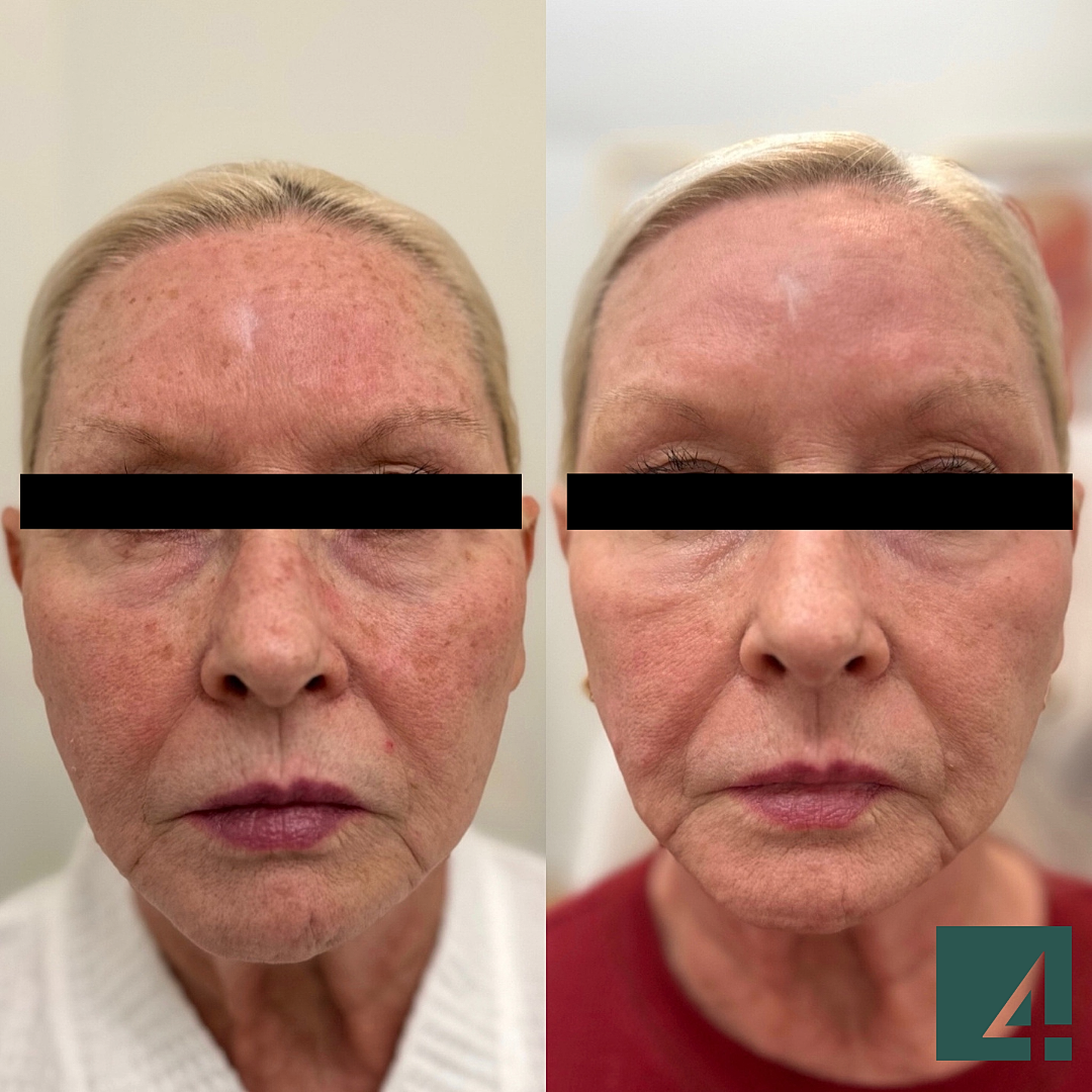 Results inside, Check this out!